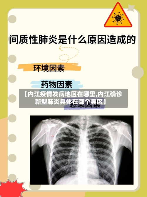 【内江疫情发病地区在哪里,内江确诊新型肺炎具体在哪个县区】-第2张图片