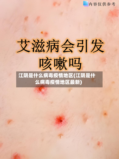 江阴是什么病毒疫情地区(江阴是什么病毒疫情地区最新)-第2张图片