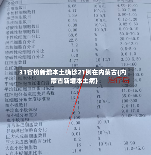 31省份新增本土确诊21例在内蒙古(内蒙古新增本土病)-第2张图片