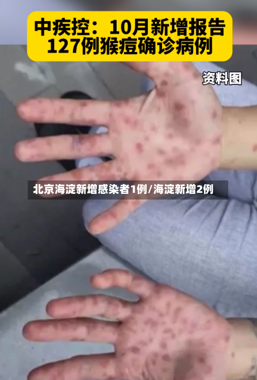 北京海淀新增感染者1例/海淀新增2例-第2张图片