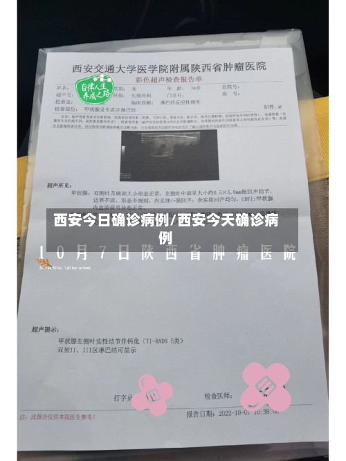 西安今日确诊病例/西安今天确诊病例