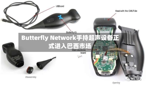 Butterfly Network手持超声设备正式进入巴西市场