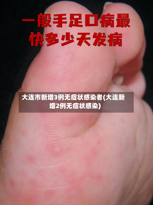 大连市新增3例无症状感染者(大连新增2例无症状感染)