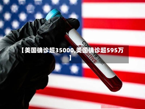 【美国确诊超35000,美国确诊超595万】-第3张图片