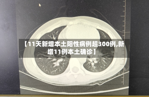 【11天新增本土阳性病例超300例,新增11例本土确诊】-第2张图片