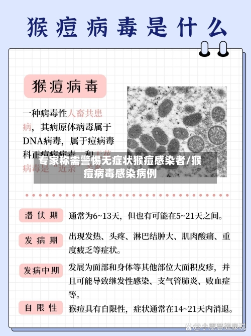 专家称需警惕无症状猴痘感染者/猴痘病毒感染病例