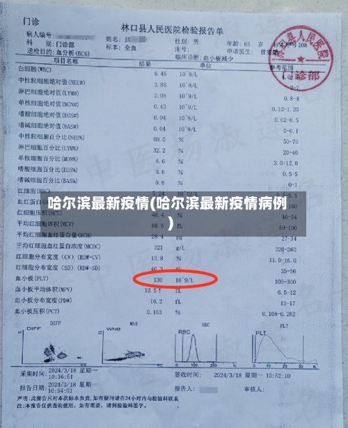 哈尔滨最新疫情(哈尔滨最新疫情病例)-第2张图片